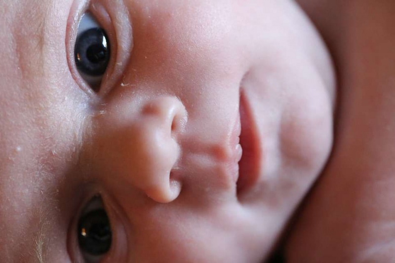 为什么婴儿脸上皮肤粗糙婴儿脸上皮肤粗糙怎么办